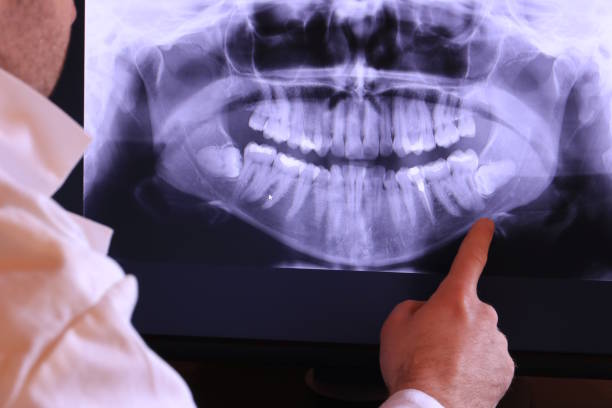 Best Urgent Tooth Repair  in Enosburg Falls, VT