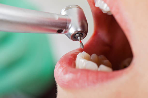 Best Dentist for Severe Toothache  in Enosburg Falls, VT